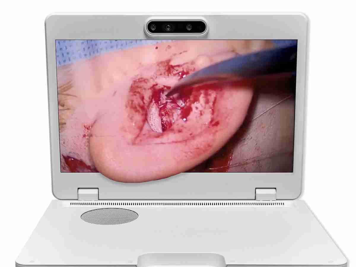 达擎之＂Heads-up 3D显微手术显示系统＂，，，，整合4K裸眼3D显示及眼球追踪系统，，具备快速追踪人眼移动位置功能，，减轻医师长时间维持固定姿势的负担，，，，让医师能有更宽广清晰的3D立体视野及更舒适的姿势来执行手术。。。